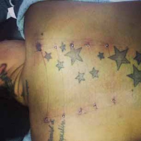 Se pueden hacer en el brazo, la pierna, o una variedad de otras ubicaciones en el cuerpo.