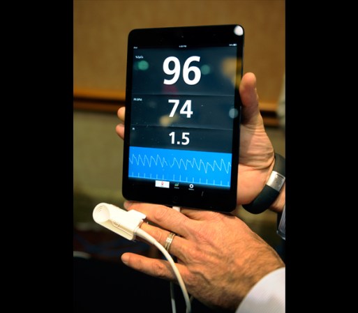 Un oxímetro de pulso iSpO2 monitorea la salud del usuario y junto a un dispositivo móvil puede grabar, guardar y transmitir estadísticas vitales.