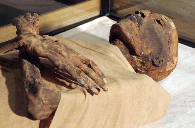 Faraón Ramsés IV, gobernó su nación, Egipto, de 1152 a 1145 antes de Cristo. Murió a los 50 años.