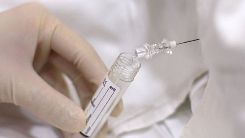Van 249 casos de meningitis