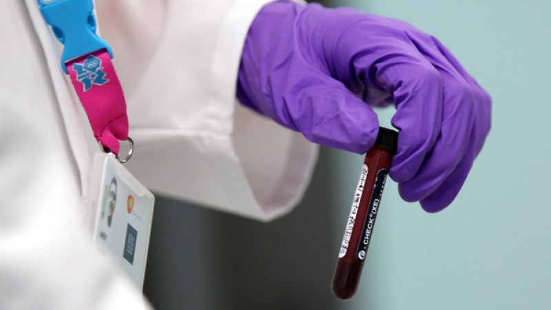 Muestra de sangre detectaría cáncer