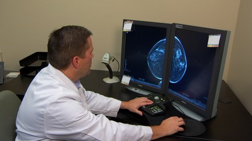 3d mammograms