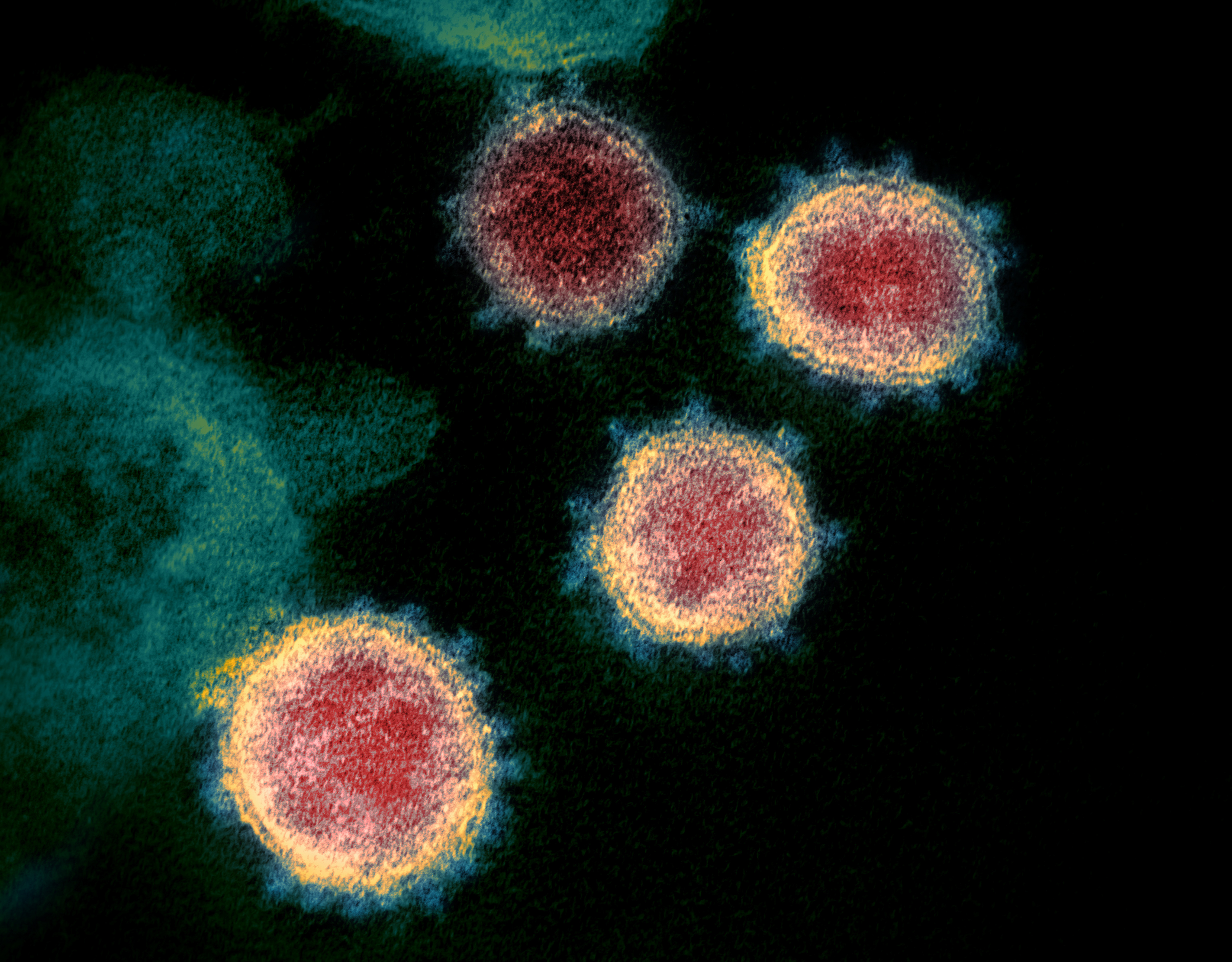 This transmission electron microscope image shows SARS-CoV-2