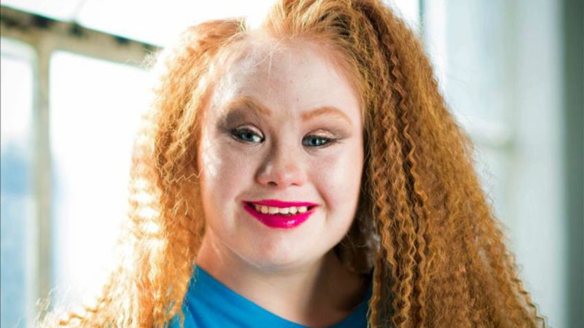 TLMD-Madeline-stuart-modelo-sindrome-de-down-en-new-york-11087261w