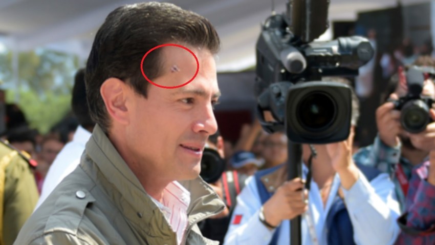 mexico-pena-nieto-herida-frente