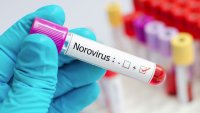 Alertan por aumento en los casos del norovirus: de qué se trata la gripe estomacal
