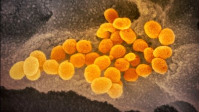 Tiene síntomas similares al coronavirus: qué es el síndrome de Kawasaki
