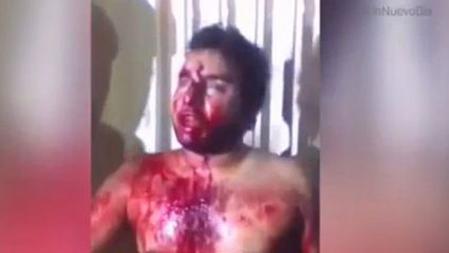 tlmd_estudiante_venezuela_ok