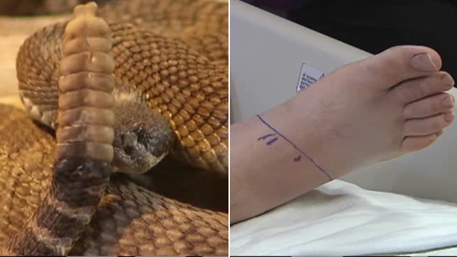 tlmd_serpiente