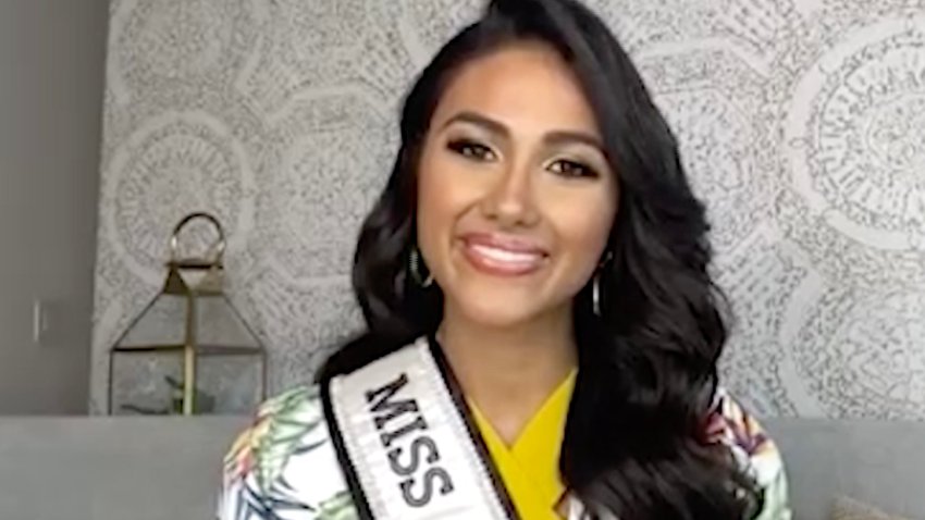 Miss Puerto Rico revela que fue víctima de “bullying” a causa del acné