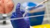 Condado Dallas habilita línea de ayuda para vacunas contra viruela del mono