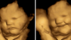El feto puede saborear y oler la comida de la madre, según estudio