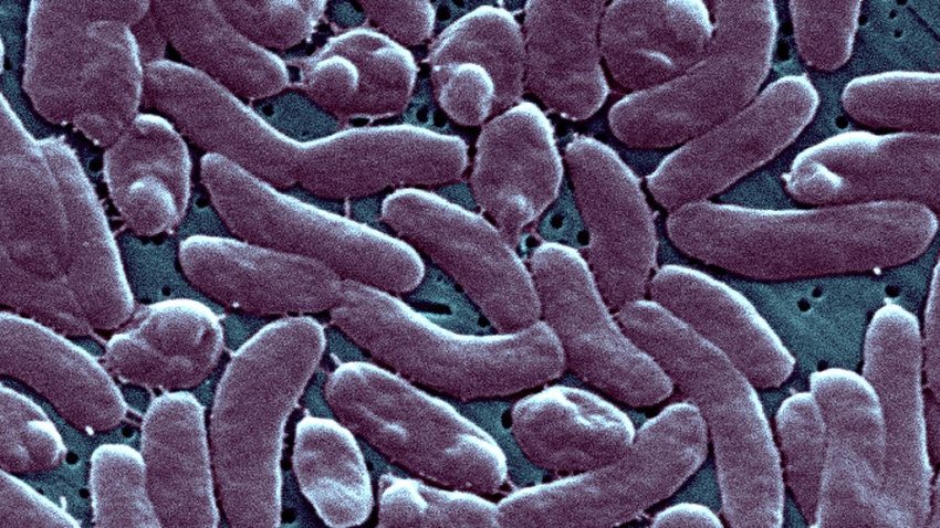 Vibrio Vulnificus, Septic Shock And Blistering Skin Lesions, V, Vulnificus Bloodstream Infections Are Fatal About 50 percent Of The Time. (Photo By BSIP/Universal Images Group via Getty Images)