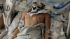 Un milagro: quedó en coma hace 9 meses tras brutal asalto y ahora está despertando