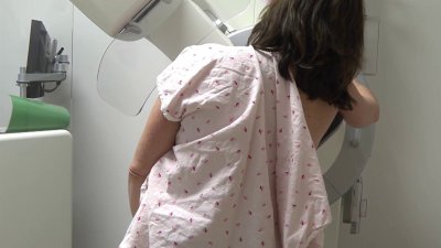 Aumentan diagnósticos de cáncer de mama en EEUU