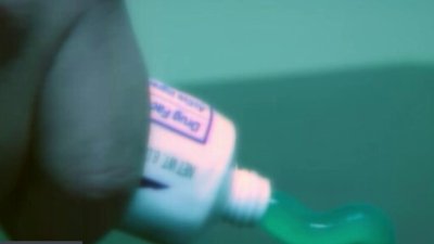 “¿Lo Sabías?”: ¿es bueno ponerse pasta de dientes sobre quemaduras?