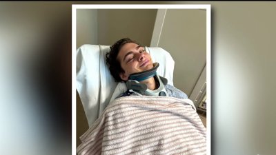 Joven enfrenta larga recuperación tras ser atropellado; buscan al sospechoso