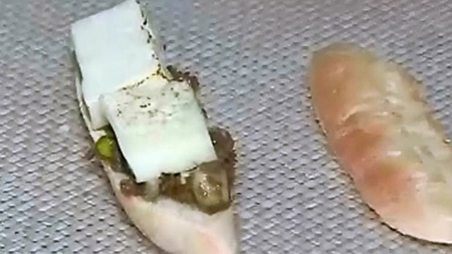 Puré de papas y camote para personas con llagas en su boca u otros problemas para comer