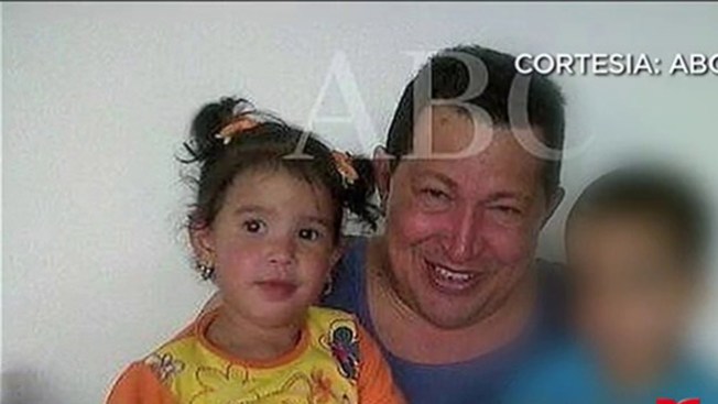 Puré de papas y camote para personas con llagas en su boca u otros problemas para comer